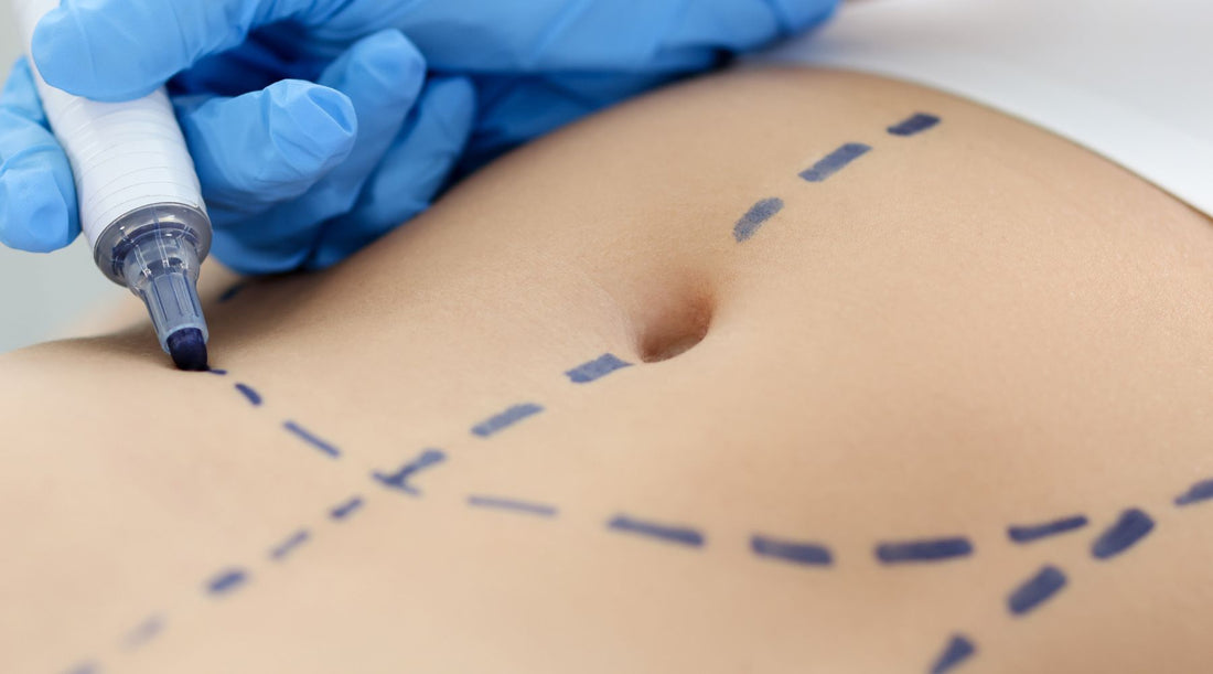 The Rise and Fall (and Rise Again?) of Lipoplasty